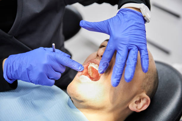 Best Emergency Denture Repair in Rutland, VT